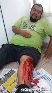 fake wound makeup first aid