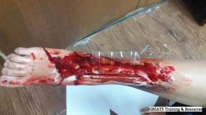 fake wound makeup first aid