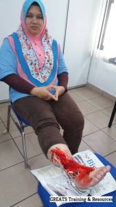 fake wound makeup first aid